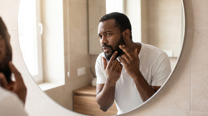 Beard Pimples: What's Actually Causing Spots Under Your Beard
